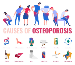 Save your bones! : Understand Osteoporosis