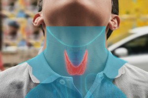 Thyroid disease: Hypothyroid