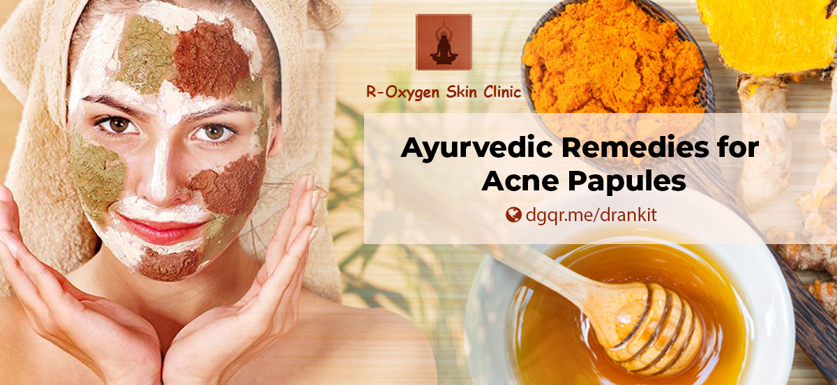 Powerful Home Remedies for Acne Treatment