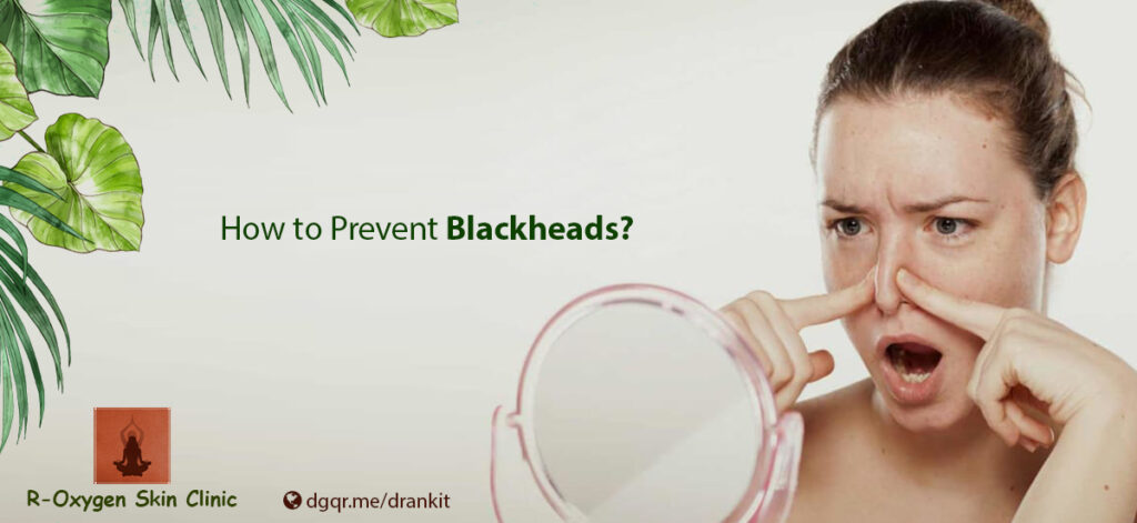 Heal Blackheads using Ayurvedic Treatment!